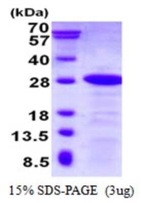 SDS-PAGE: Recombinant Human DBNDD2 His Protein [NBP1-98865]