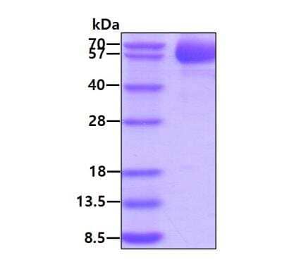 SDS-PAGE: Recombinant Human DC-LAMP His Protein [NBP2-52299]