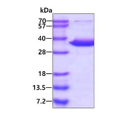 SDS-PAGE: Recombinant Human DCK His Protein [NBP1-49305]