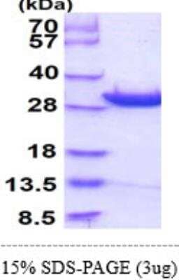 SDS-PAGE: Recombinant Human DCUN1D1 His Protein [NBP1-50965]