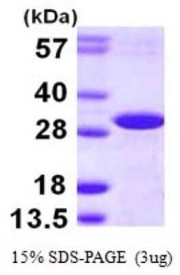 SDS-PAGE: Recombinant Human DCUN1D2 His Protein [NBP1-72402]