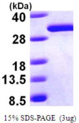 SDS-PAGE: Recombinant Human DCXR His Protein [NBP1-50835]