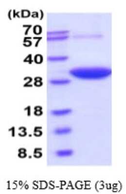 SDS-PAGE: Recombinant Human DCXR His Protein [NBP2-59543]