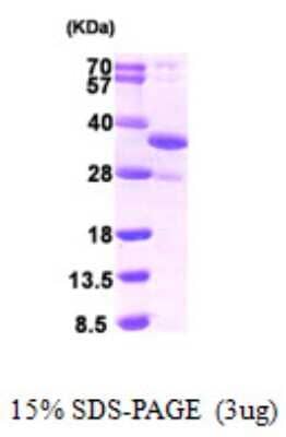 SDS-PAGE: Recombinant Human DDIT4 His Protein [NBP1-50976]