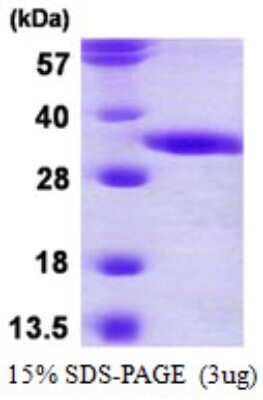 SDS-PAGE: Recombinant Human DECR2 His Protein [NBP1-78829]