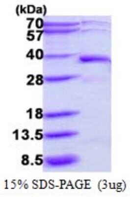 SDS-PAGE: Recombinant Human DERA His Protein [NBP1-78809]