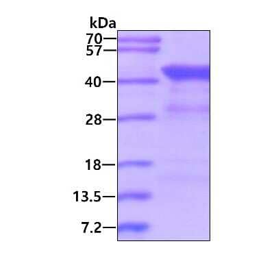 SDS-PAGE: Recombinant Human DFF45/ICAD His Protein [NBP1-30202]