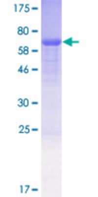 SDS-PAGE: Recombinant Human DGCR14 GST (N-Term) Protein [H00008220-P01]