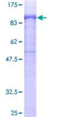 SDS-PAGE: Recombinant Human DGK-alpha GST (N-Term) Protein [H00001606-P01]