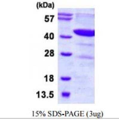 SDS-PAGE: Recombinant Human DHODH His Protein [NBP1-98916]