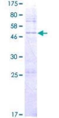 SDS-PAGE: Recombinant Human DHRS4L2 GST (N-Term) Protein [H00317749-P01]