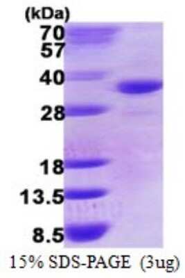 SDS-PAGE: Recombinant Human DHRS9 His Protein [NBP1-78842]