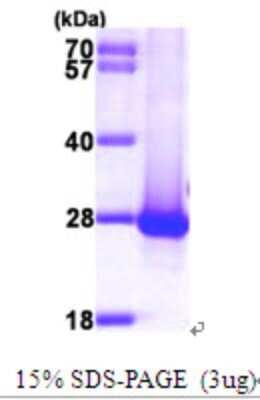 SDS-PAGE: Recombinant Human DIRAS1 His Protein [NBP1-48597]