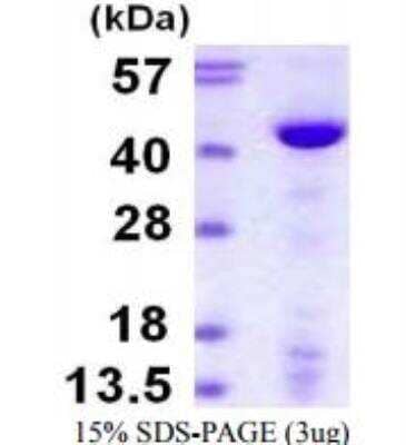 SDS-PAGE: Recombinant Human DNA Polymerase beta His Protein [NBP1-72434]