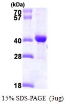 SDS-PAGE: Recombinant Human DNAJB2 His Protein [NBP1-50874]