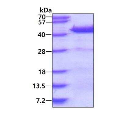 SDS-PAGE: Recombinant Human DNAJB4 His Protein [NBP2-23005]