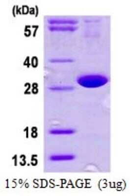 SDS-PAGE: Recombinant Human DNAJB8 His Protein [NBP1-72504]