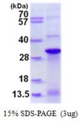 SDS-PAGE: Recombinant Human DNAJC12 His Protein [NBP1-98896]