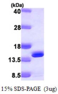 SDS-PAGE: Recombinant Human DNAJC19 His Protein [NBP1-50990]