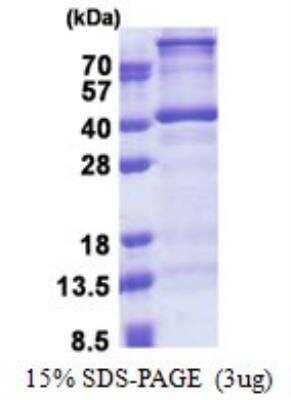 SDS-PAGE: Recombinant Human DNTTIP1 His Protein [NBP2-22994]