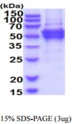 SDS-PAGE: Recombinant Human DPH2 His Protein [NBP2-59649]