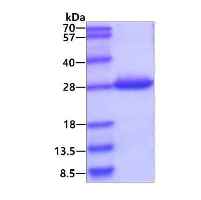 SDS-PAGE: Recombinant Human DTYMK His Protein [NBP1-72360]