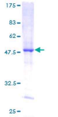 SDS-PAGE: Recombinant Human DUSP14 GST (N-Term) Protein [H00011072-P01]