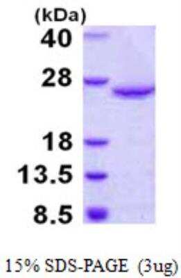 SDS-PAGE: Recombinant Human DUSP18 His Protein [NBP1-99084]