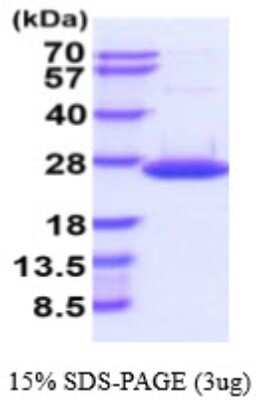 SDS-PAGE: Recombinant Human DUSP18 His Protein [NBP2-59583]