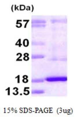 SDS-PAGE: Recombinant Human DUSP19 His Protein [NBP1-78816]