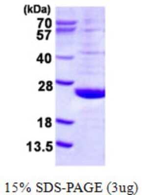 SDS-PAGE: Recombinant Human DUSP21 His Protein [NBP1-78892]