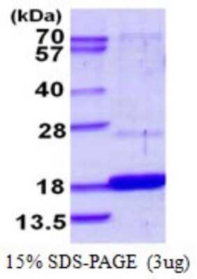 SDS-PAGE: Recombinant Human DUSP23 His Protein [NBP1-72536]