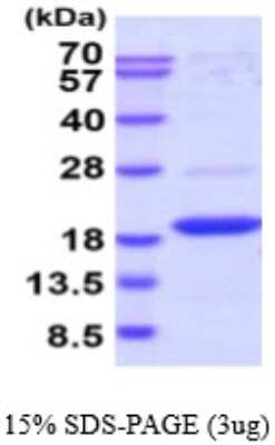 SDS-PAGE: Recombinant Human DUSP23 His Protein [NBP2-59584]