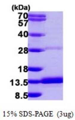 SDS-PAGE: Recombinant Human DYNLRB2 His Protein [NBP1-78800]