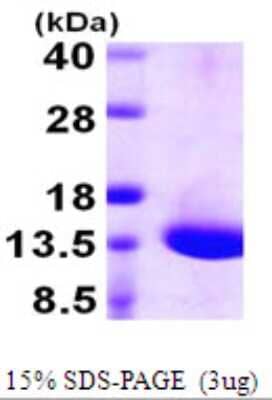 SDS-PAGE: Recombinant Human DYNLT1 His Protein [NBP1-51097]