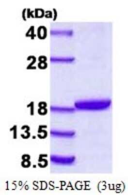 SDS-PAGE: Recombinant Human Destrin His Protein [NBP1-98933]