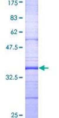 SDS-PAGE: Recombinant Human Dopamine D2R/DRD2 GST (N-Term) Protein [H00001813-Q01]