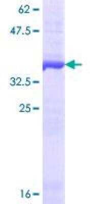 SDS-PAGE: Recombinant Human Drosha GST (N-Term) Protein [H00029102-Q01]