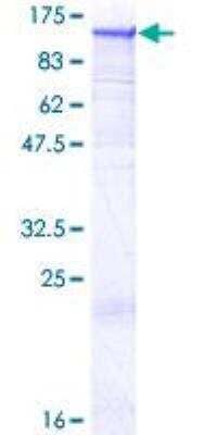 SDS-PAGE: Recombinant Human Dynamin 2 GST (N-Term) Protein [H00001785-P01]