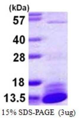 SDS-PAGE: Recombinant Human Dynein light chain 2 cytoplasmic His Protein [NBP1-72333]