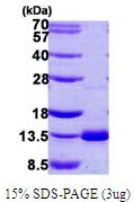 SDS-PAGE: Recombinant Human Dynein light chain 4 His Protein [NBP1-72311]