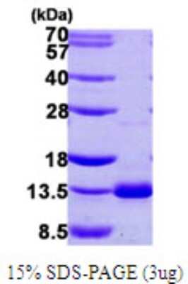 SDS-PAGE: Recombinant Human Dynein light chain 4 His Protein [NBP1-72311]