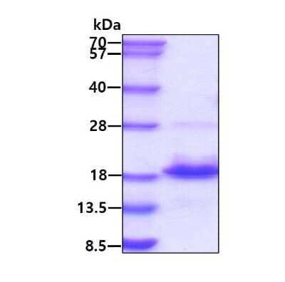 SDS-PAGE: Recombinant Human EAF1 His Protein [NBP2-51550]