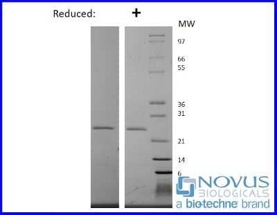 SDS-PAGE: Recombinant Human EBI3 Protein [NBP2-76293]