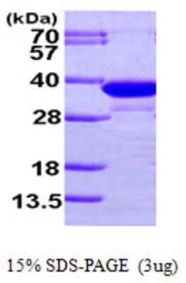 SDS-PAGE: Recombinant Human ECH1 His Protein [NBP1-48389]