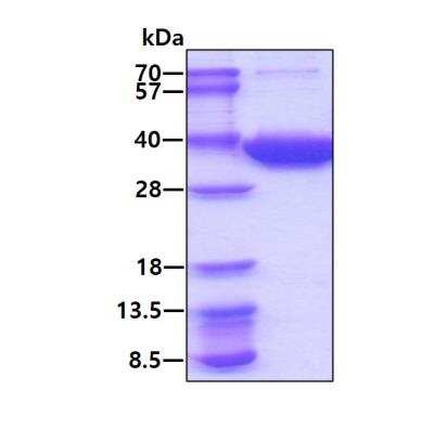 SDS-PAGE: Recombinant Human ECHDC1 His Protein [NBP1-99095]
