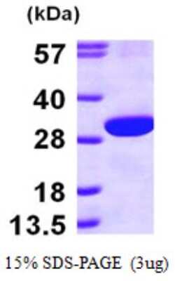 SDS-PAGE: Recombinant Human ECHS1 His Protein [NBP1-48360]