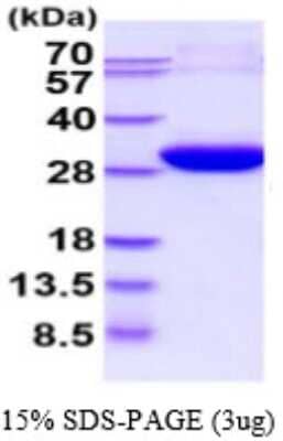 SDS-PAGE: Recombinant Human ECHS1 His Protein [NBP2-59588]