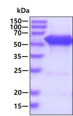 SDS-PAGE: Recombinant Human EED His Protein [NBP2-23020]