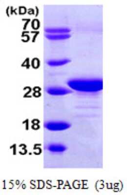 SDS-PAGE: Recombinant Human EEF1B2 His Protein [NBP1-51020]